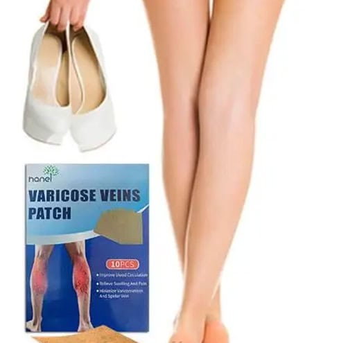 Varicose Veins — GoGo